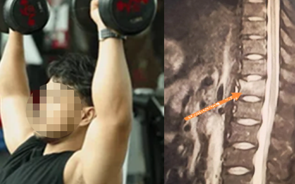 Người đàn ông 34 tuổi xương giòn như bà cụ 60 tuổi vì ngày nào cũng uống 3 cốc loại nước nhiều người không thể sống thiếu