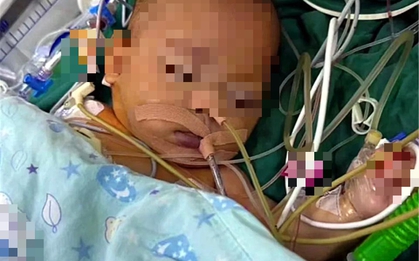 Kỳ lạ em bé 5 tháng tuổi nôn mửa và chán ăn nhưng không khóc tiếng nào, bác sĩ phát hiện sự thật đáng sợ phía sau