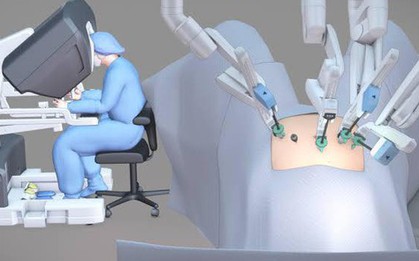 Mổ bằng robot có thực sự tốt hơn không?