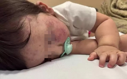 Bé trai 11 tháng tuổi tử vong sau 5 tiếng chờ bác sĩ, người mẹ đau khổ nói: "Lẽ ra con tôi có thể được cứu"