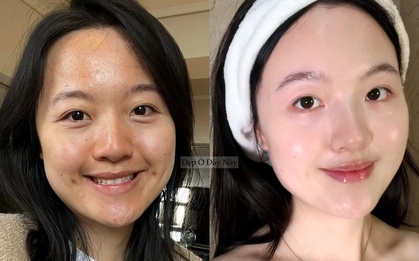 Làm 5 việc này khi đi ngủ, làn da của tôi như "thay da đổi thịt" hoàn toàn