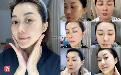 Đi ngủ sớm và bôi thứ này lên da mỗi tối, làn da của tôi sau 1 tháng đã thay đổi hoàn toàn