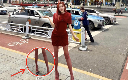 Đôi chân mảnh như tăm tre của Trang Pháp, nhìn thôi đã thấy bất an