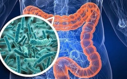 Những thói quen đang "nuôi dưỡng" ung thư đại trực tràng: Đừng xem nhẹ 4 tín hiệu cảnh báo từ cơ thể!