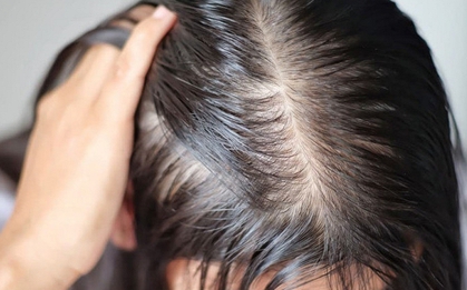 Lời khuyên cho những người hay bị rụng tóc