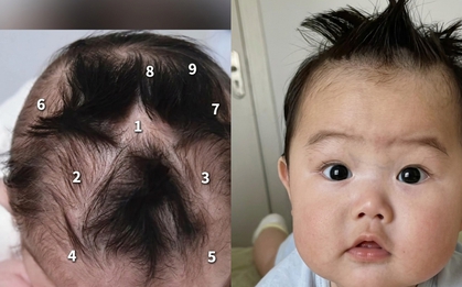 Em bé gây chú ý vì có tới 9 xoáy tóc trên đầu: Liệu có điều gì đặc biệt liên quan đến não bộ của bé?