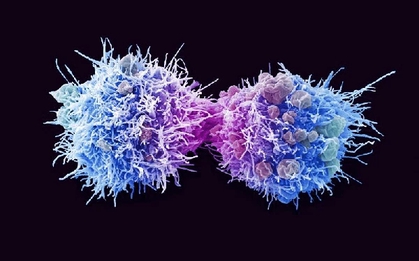 Loại virus âm thầm có thể gây ung thư ở cả nam và nữ