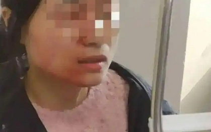 Cô giáo tiểu học bị đâm vỡ nhãn cầu vì can ngăn học sinh đánh nhau: Kẻ thủ ác không bị xử phạt vì chưa đủ 14 tuổi!