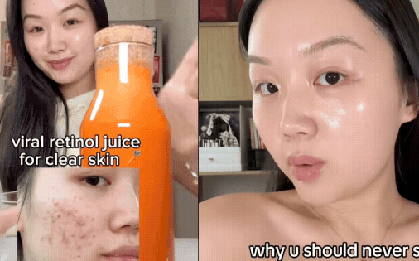 Để cứu làn da chi chít mụn, cô nàng Hàn Quốc uống loại nước ép đẹp da uống 2 lần/tuần, kết quả da đẹp ngoài sức tưởng tượng