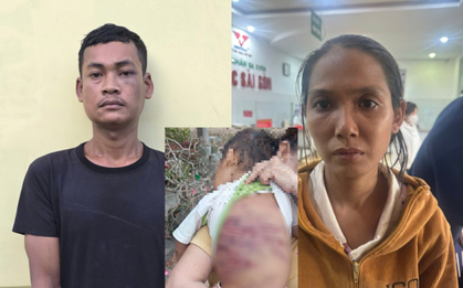 Bắt khẩn cấp đôi nhân tình hành hạ dã man bé trai 2 tuổi gây phẫn nộ dư luận ở TP.HCM