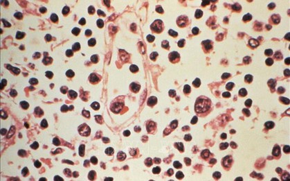 Đài Loan ghi nhận 1 ca tử vong do nhiễm virus Hanta