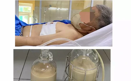 Hút ra hàng lít mủ từ phổi người đàn ông ở Đà Nẵng