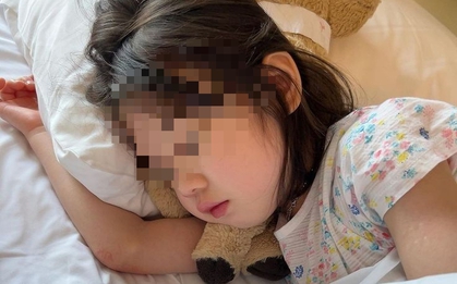 Bé gái 8 tuổi đã khổ sở vì gan nhiễm mỡ, bác sĩ tức giận: Đừng khen con thế này nữa!