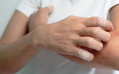 Thức khuya, ăn đồ ăn giao tận nhà suốt nhiều năm, người phụ nữ ân hận nhận "tin dữ" ung thư