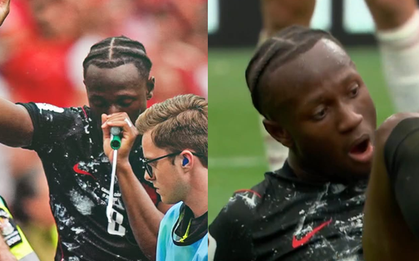 Ngôi sao Canada gãy chân rùng rợn ở World Cup hít cái gì màu xanh?