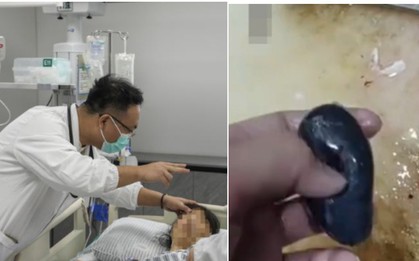 Người phụ nữ suy gan cấp vì mẹo dân gian chữa đau đầu, bác sĩ nói thẳng: Phần này của cá độc hơn thạch tín!