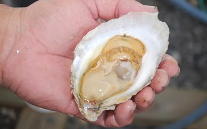Người đàn ông 50 tuổi bị suy thận cấp sau khi ăn hàu sống