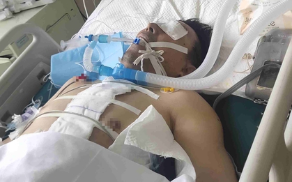 Người đàn ông nguy kịch vì trắng xóa cả 2 bên phổi: Bác sĩ cảnh báo 1 kiểu dùng điều hòa ngang "tự sát"