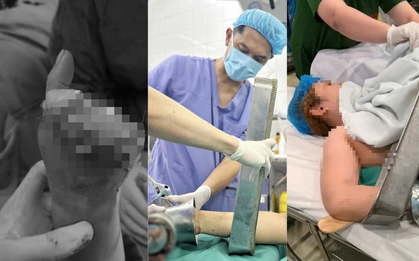 Cảnh báo bất cứ ai đang dùng máy xay thịt
