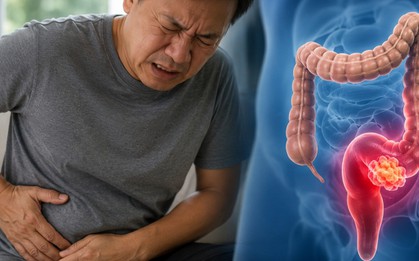 Bác sĩ cảnh báo: 4 DẤU HIỆU sớm của ung thư trực tràng, nhiều người nhầm với đau, chướng bụng bình thường