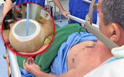 Người đàn ông tử vong sau khi uống 1 ngụm nước dừa, bác sĩ khẩn thiết: Càng mùa hè càng như "thuốc độc"