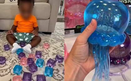 Cảnh báo về món đồ chơi hot Tiktok hàng triệu người đang mua: Con chỉ làm theo một video trên mạng, hậu quả là bỏng mặt và cánh tay