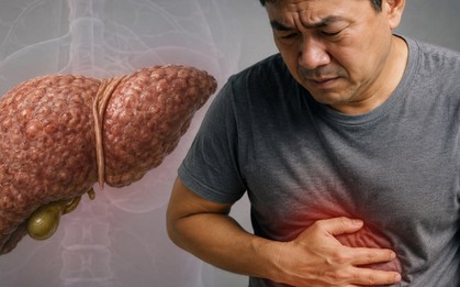 Bác sĩ chỉ: 5 ĐIỀU cảnh báo suy gan, nhiều người chỉ tưởng cơ thể đang "lão hóa"