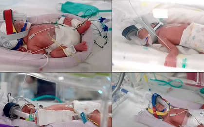 Ca sinh 4 cùng trứng cực hiếm, tỷ lệ chỉ 1/15 triệu ca mang thai