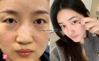 Vì sao càng dưỡng nhiều da càng xấu? 5 sai lầm khiến skincare mãi không hiệu quả