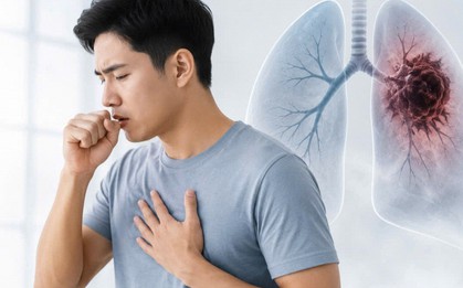 Không phải cơn ho: Bác sĩ cho biết ngón tay đôi khi là nơi đầu tiên cảnh báo ung thư phổi