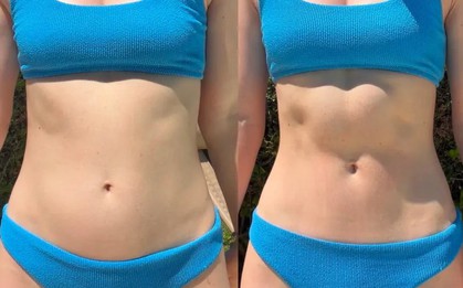 Nữ y tá 25 tuổi tiết lộ cách giảm gần 3kg chỉ trong 5 phút không cần bất cứ dụng cụ gì, vợ Justin Bieber cũng rất "chuộng"