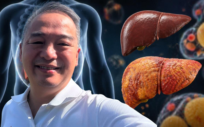 Lời khuyên của Giám đốc Bệnh viện Đại học y Hà Nội đến người bị gan nhiễm mỡ