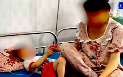 Triệu tập người cha dượng đánh tím mặt con riêng của vợ