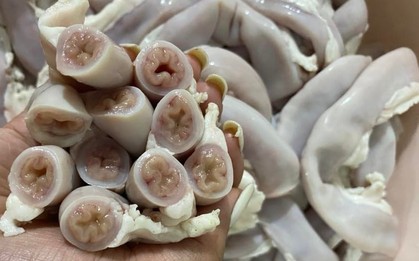 'Lòng se điếu' hình thành từ ruột non nhiễm giun sán, nhiễm độc
