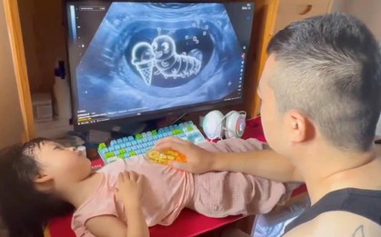 Đoạn clip ghi lại cảnh bố... siêu âm cho con gái "gây bão" MXH: Người khen cách dạy dỗ sáng tạo, người chê "lừa dối trẻ con"!