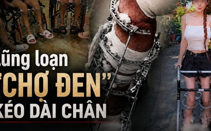 Điều tra: Bên trong "chợ đen" phẫu thuật tăng chiều cao, hơn 1,5 tỷ đồng đổi lấy từng milimét và những ca mổ không lộ mặt bác sĩ