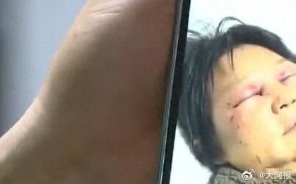 Con dâu đánh gãy xương sườn mẹ chồng vì không chịu trông cháu, con trai bênh vợ khẳng định “mẹ có lỗi trước"