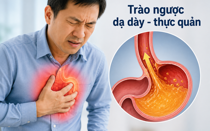 Đau ngực tưởng mắc bệnh tim, bác sĩ phát hiện 'thủ phạm' từ dạ dày
