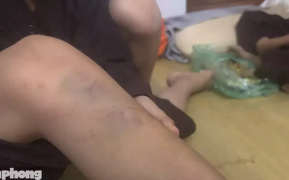 Vụ bạo hành trẻ tại chùa Bầu, Phú Thọ: Nhiều cháu có thương tích