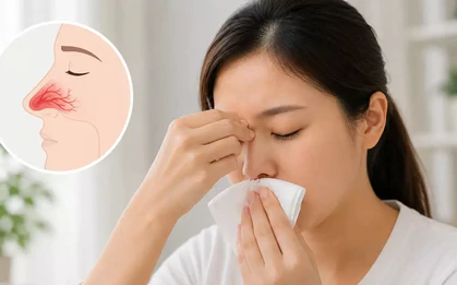 Chảy máu cam có phải dấu hiệu của ung thư?