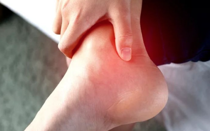 25-30 tuổi đã mắc gút: Bác sĩ chỉ thẳng những thói quen gây hại