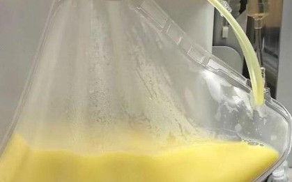 Người đàn ông 32 tuổi máu "trắng đục như sữa" sau khi ăn món thịt quen thuộc