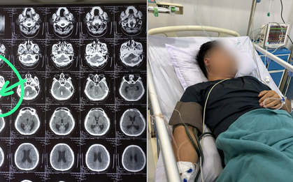 Người vợ quyết đưa chồng vượt 1.000km về Việt Nam giành lại sự sống