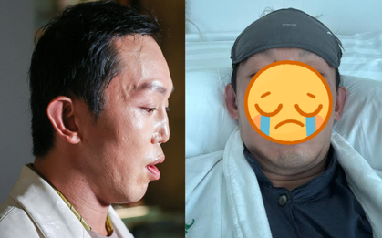 Nam thần màn ảnh vỡ nát mặt mũi sau vụ bị xe tông, tốn 13 tỷ sửa dung mạo bố mẹ vẫn nhận không ra