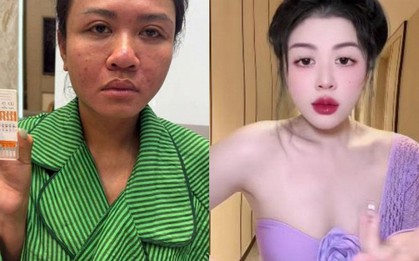 Bắt TikToker Phan Nhi Beauty Phan Kim Nhi 1989