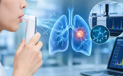 Nghiên cứu công nghệ nhận diện nốt phổi có nguy cơ ung thư từ hơi thở