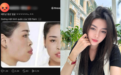 Người đẹp lột xác thành công nhờ "dao kéo" vướng lùm xùm liên quan đến miệt thị ngoại hình người Việt