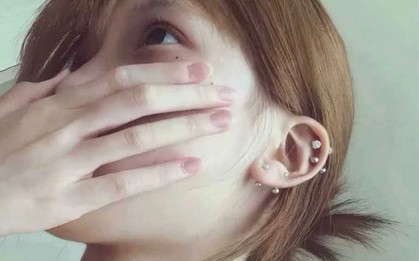 4 bất thường ở vùng đầu cảnh báo tế bào ung thư đang "gặm nhấm" lá phổi