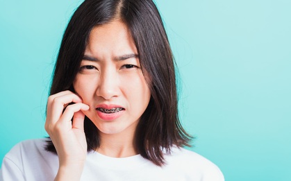 Niềng răng như không niềng? Khám phá ngay bí mật được các nha sĩ hàng đầu bật mí!