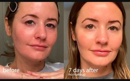 Ở nhà cả tháng không được đi làm đẹp, sao bạn không thử phương pháp Peel da tại nhà?